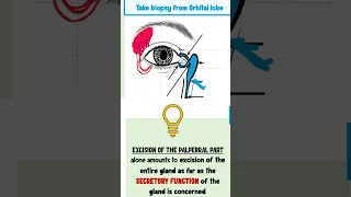 lacrimal apparatus anatomy  #ophthalmology