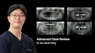 Advanced Case Review by Dr. Kang Jaeseok