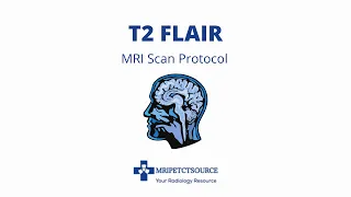 MRI Sounds Explained- T2 FLAIR MRI