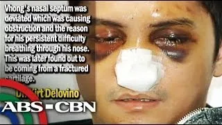 TV Patrol: Vhong confirms case with NBI despite his 5 hour surgery