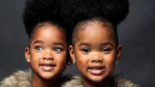 Do you remember the blue eyes twins? See how they looks like today