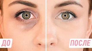 DIY FOR UNDER EYE CIRCLES