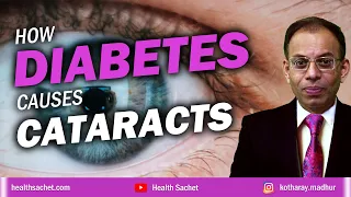 How diabetes causes cataracts