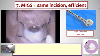 What is the Role of MIGS for a Busy Cataract Surgeon - Webcast