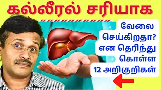 கல்லீரல் பாதிப்பை காட்டும் 12 அறிகுறிகள் | 12 signs of liver damage