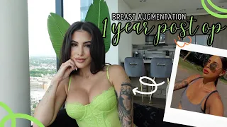 BREAST AUGMENTATION 1 YEAR POST OP | Q+A,  pictures, do I regret it?
