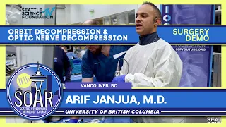 Orbit Decompression and Optic Nerve Decompression - Arif Janjua, M.D.