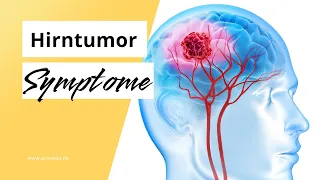 Hirntumor: Diese 6 Symptome sind möglich bei einer Hirngeschwulst