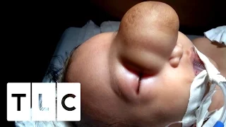 Life-Changing Surgery for Baby Boy | Body Bizarre