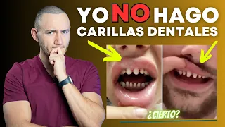 YO NO HAGO CARILLAS DENTALES