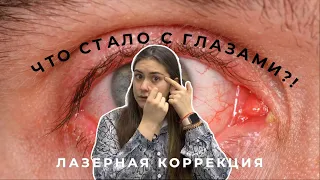 ЛАЗЕРНАЯ КОРРЕКЦИЯ ЗРЕНИЯ || ВСЯ ПРАВДА