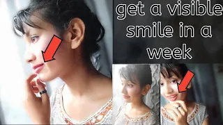 how to get a wider smile | how to get a korean smile | visible smile exercise