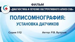 Как проводится полисомнография для диагностики обструктивного апноэ сна. Постановка датчиков