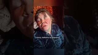 Синдром картошки😂😂😂 #юмор #приколы #топ #паримжарим