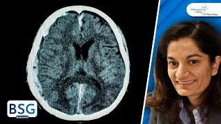 Traumatic Brain Injury Grand Rounds | Neurosurgery Course | May 16, 2023