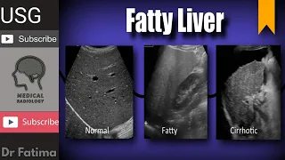 Liver normal echogenicity & fatty liver with texture complete ultrasound lecture by Dr.Fatima