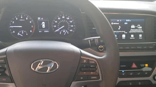 2018 Hyundai Elantra Lights On But Won't Start FIX