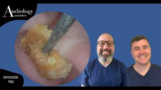 FALSE FUNDUS, SKIN WRAPPED EAR WAX PLUGS & HEARING AID DOME REMOVAL - EP782