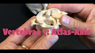 Vertebrae 1 Atlas & Axis