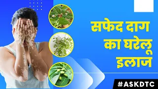 Effective Home Remedies To Treat Vitiligo| Dr. Rohit Goel