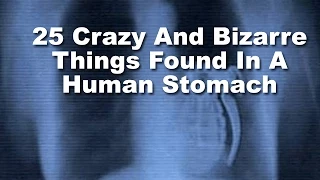 25 Crazy And Bizarre Things Found In A Human Stomach