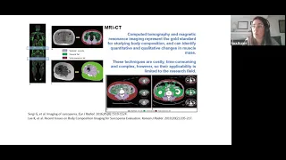 Sarcopenia y composición corporal en pacientes con artritis reumatoidea