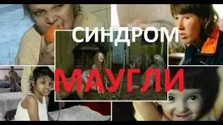 СИНДРОМ МАУГЛИ | 5-ь детей воспитанных животными! МРАК!!!