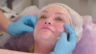 Как выглядеть моложе после 45 лет? Ботокс (Botox) и Принцесс Филлер (Princess Filler)