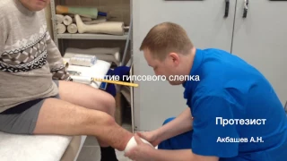 видеоотчет по изготовлению модульного протеза нижней конечности при ампутации голени