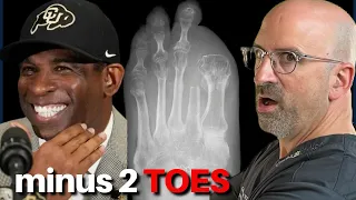 Deion Sanders Reveals Amputated Toes