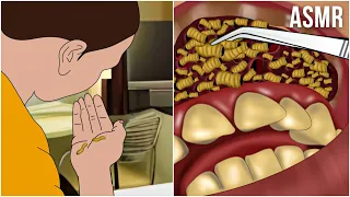 Incredible! Maggots Found Inside Human Mouth! | Parasites Removal Animation | ASMR