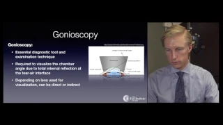 The Glaucoma Evaluation