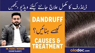 Dandruff Kyu Hota Hai - Dandruff Causes And Treatment In Urdu - Dandruff Khatam Karne Ka Tarika