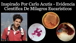 Inspirado Por Carlo Acutis - Evidencia Científica De Milagros Eucarísticos