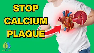 8 Ways To STOP Calcium Plaque In Your Heart Arteries