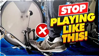 The 3 WORST Bass Drum Frustrations (and 3 exercises to FIX them!)