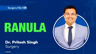 Topic | RANULA I Dr. Pritesh SIngh | Surgery