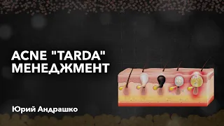 «Acne "tarda" менеджмент». Юрий Андрашко.