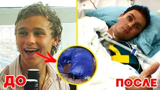 Австралиец на спор съел слизняка и умер от поражения мозга. Невероятная история  Сэма Балларда.
