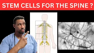 Spinal pain & Stem Cells doing it better in 2024 : New concepts and Better options