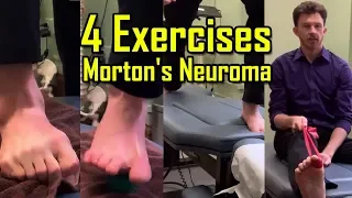 4 Exercises for Mortons Neuroma | Exercises to AVOID Surgery | How To Heal Mortons Neuroma Quickly