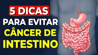 5 Dicas Para Evitar o Cancêr de Cólon (Como Prevenir o Câncer de Intestino)