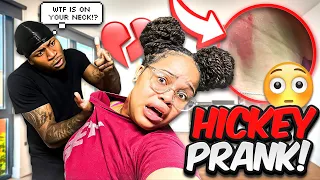 HICKEY PRANK ON BOYFRIEND! *ALMOST DIED * 😵