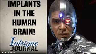 [2020] COMPUTER IMPLANTS IN THE HUMAN BRAIN THIS YEAR!