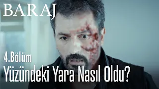 Nazım'ın yüzündeki yara izinin sırrı - Baraj 4. Bölüm