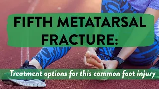 Fifth metatarsal fracture: Treatment options for this common foot injury