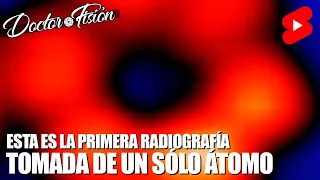 La PRIMERA RADIOGRAFÍA de UN ÁTOMO 🔬