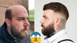 BEFORE & AFTER | Men's Hair system Transformation | BLIND REACTION - BEN