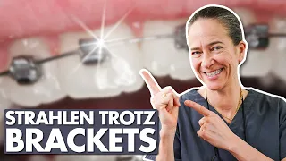 Brackets richtig pflegen: peinliche Momente vermeiden