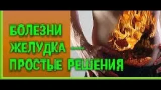 100% РЕЦЕПТ ОТ ЛЮБОЙ ЖЕЛУДОЧНОЙ ПРОБЛЕМЫ И БОЛТАЛКА 27.02. 2018 г.